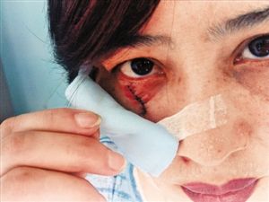 手机看新闻伤脸吗手机看新闻哪个app好
